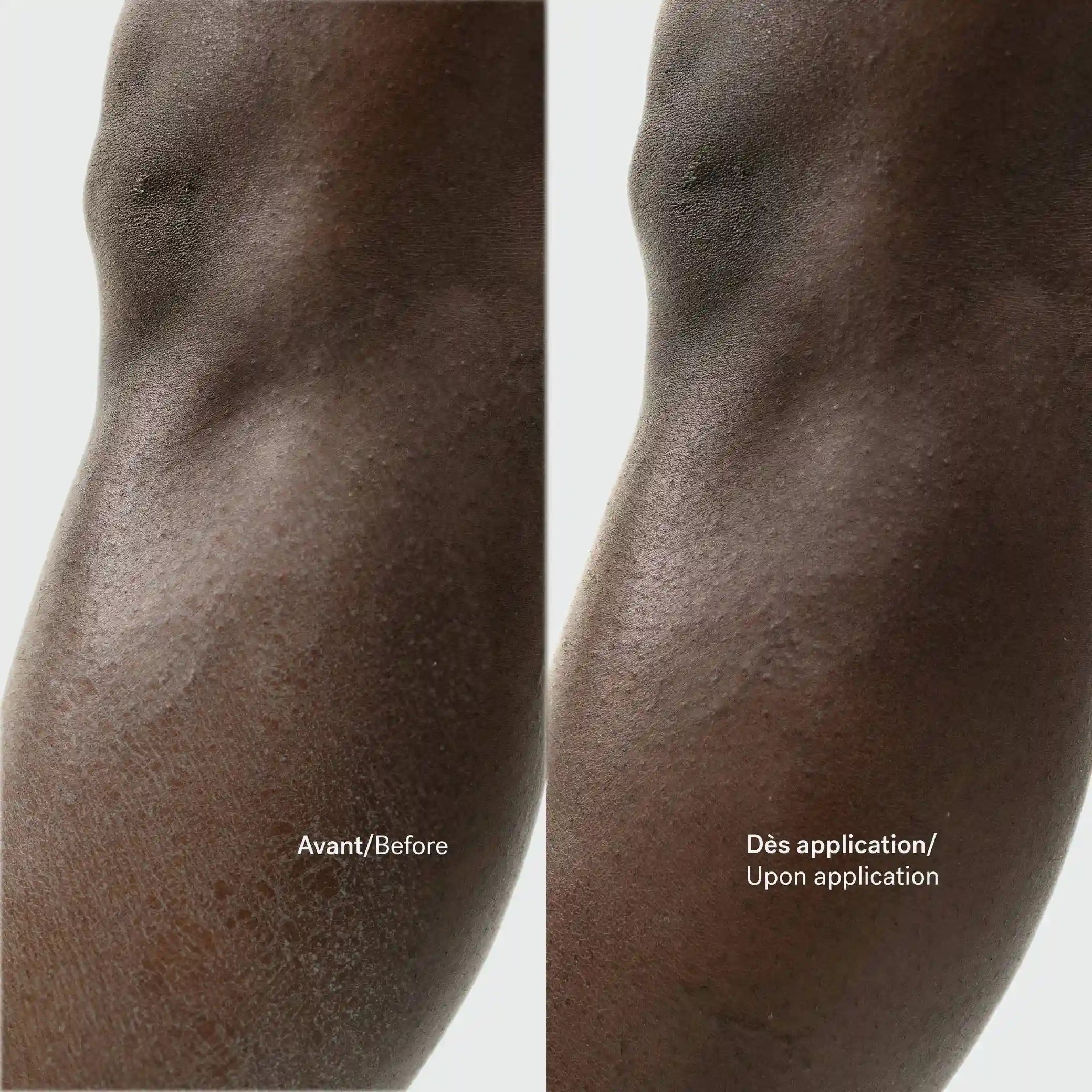 Lipid-Replenishing Balm