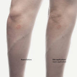 Dry Patch Relief Cream