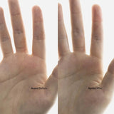 Atopic Skin Trio
