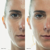 Blemish Control Face Scrub